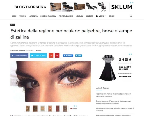 Estetica della regione perioculare