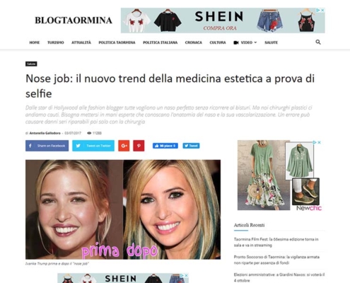 Nose job: il nuovo trend della medicina estetica a prova di selfie