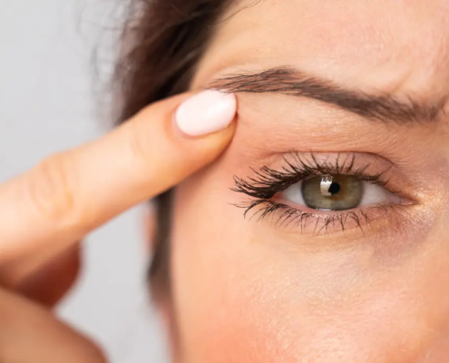 Donna insoddisfatta solleva la palpebra superiore cadente