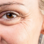Blefaroplastica: ringiovanire lo sguardo in sicurezza